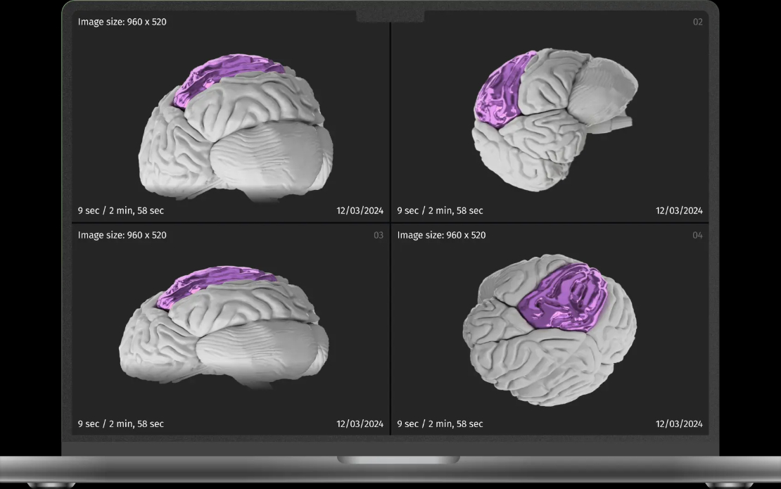 3D Medical Imaging Software Development