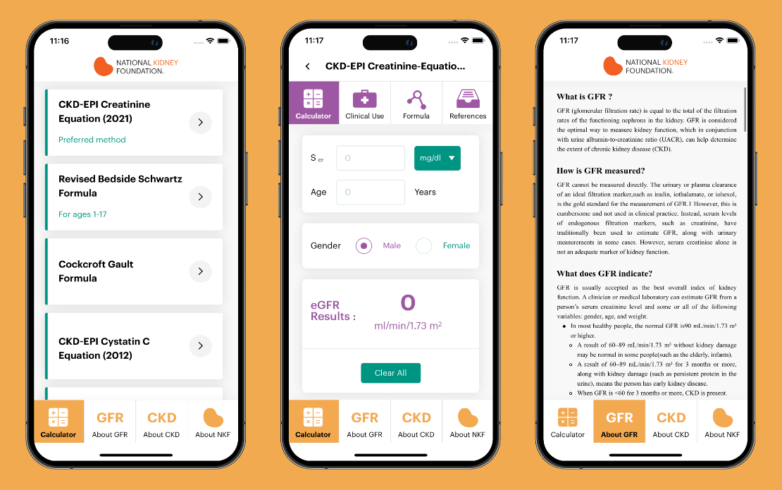 National Kidney Foundation- eGFR Calculators