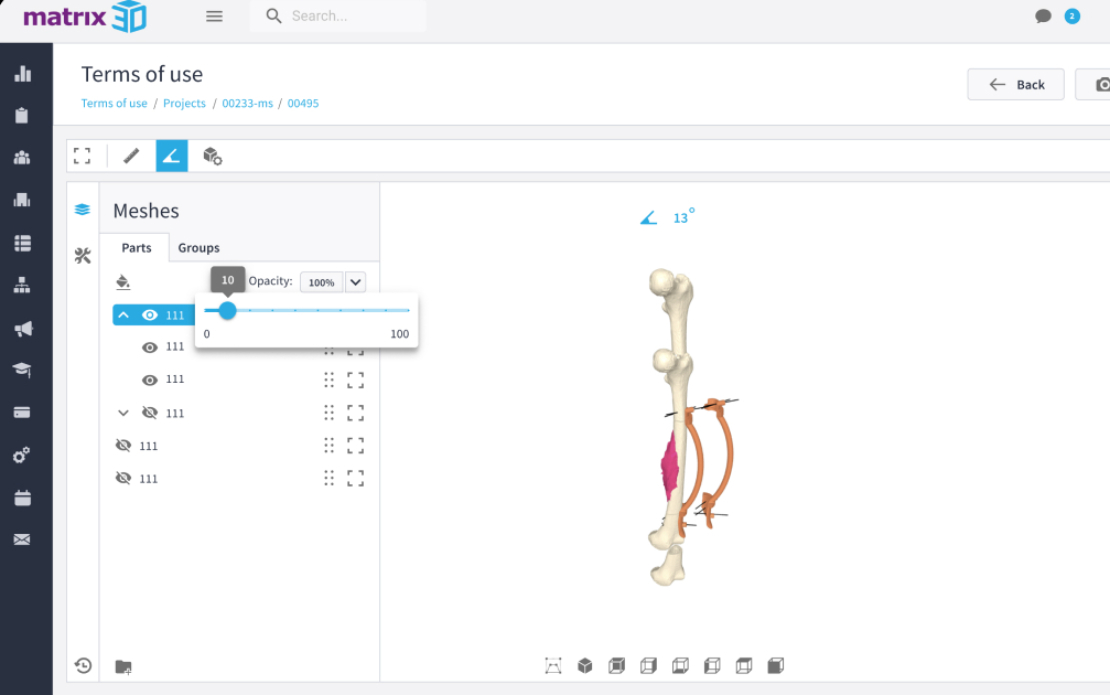 Web App for printing customized 3D models for surgery supply - Inoxoft ...