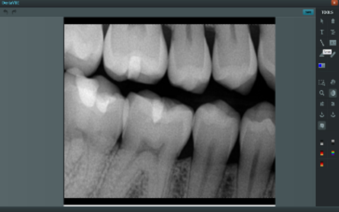 Dental Digital Imaging Software