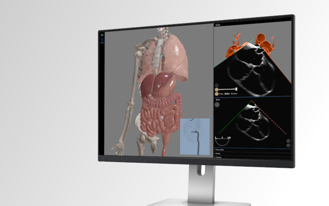 Interactive web-based 3D medical heart surgery simulator