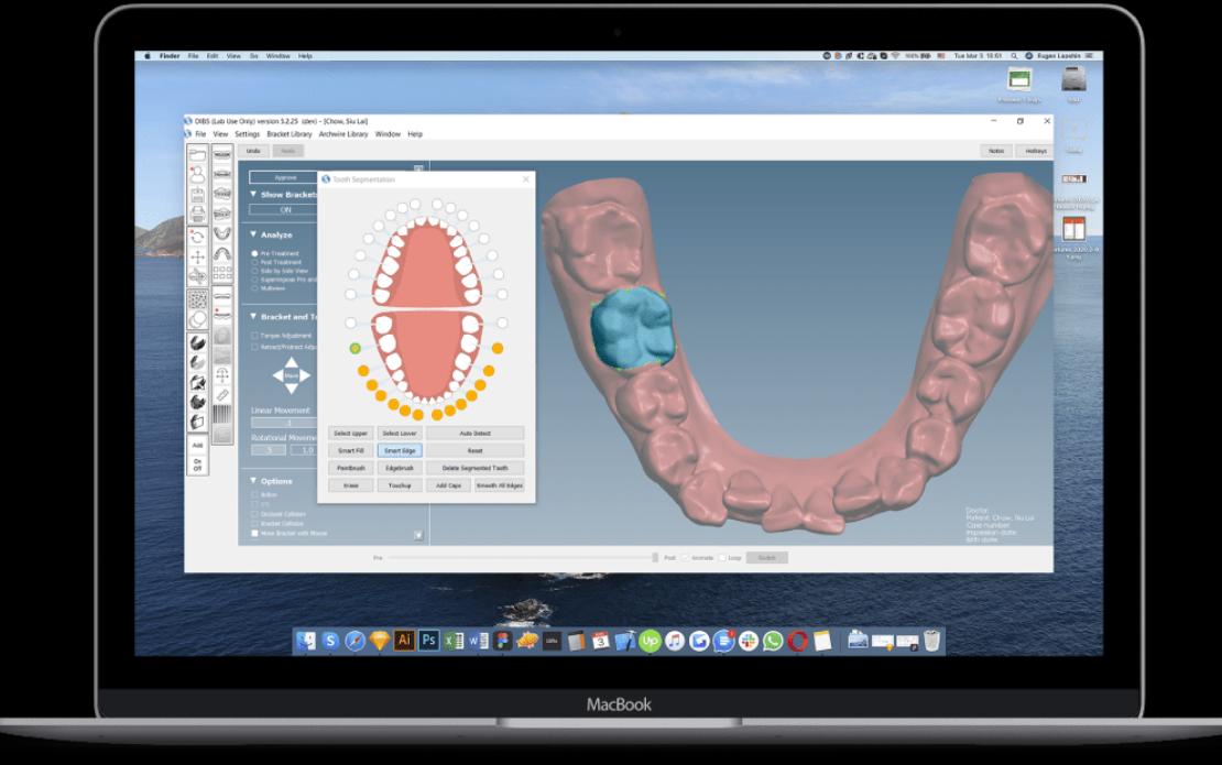 Orthoselect