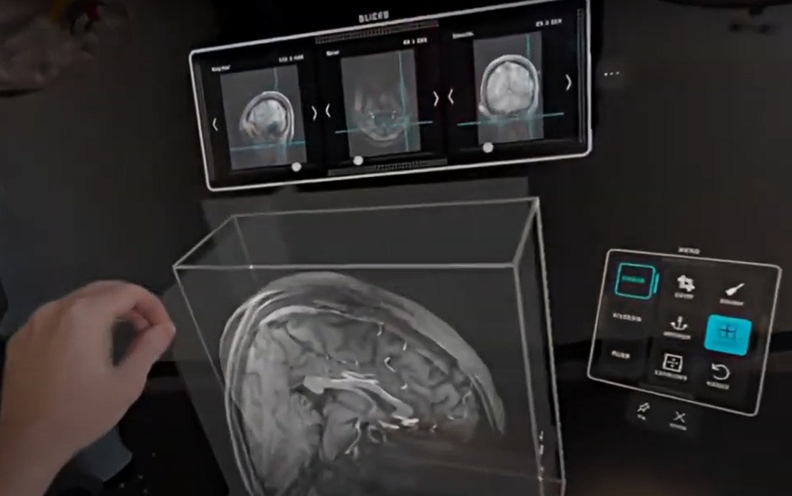 Apple Vision Pro Surgery Training
