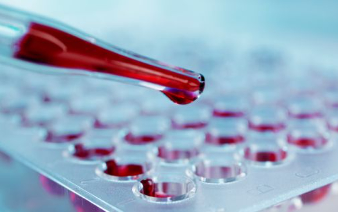 10x Greater Report Accuracy for AstraZeneca through DWH Modernization on AWS
